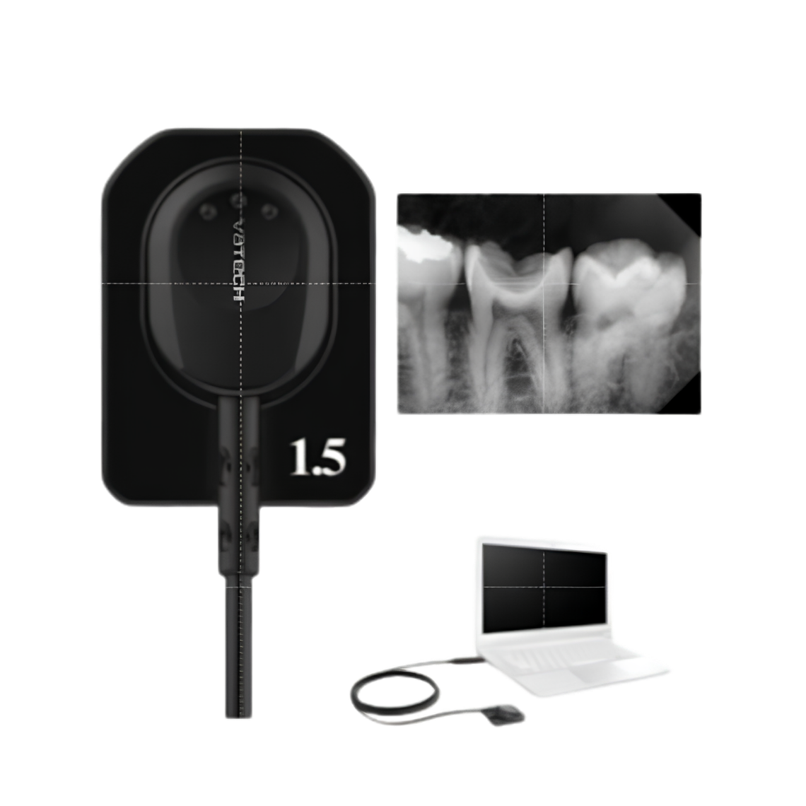 Access to RVG Dental X-ray