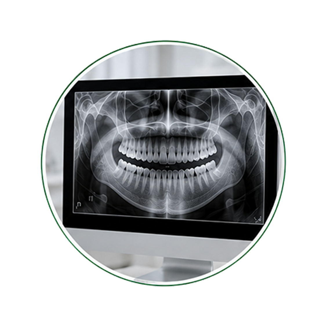 Access to RVG Dental X-ray